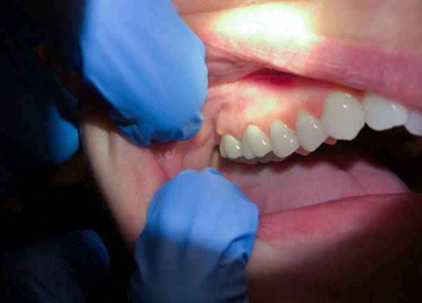 Best After-Hours Emergency Dentist in Rolling Meadows, IL