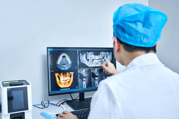 Best Emergency Tooth Extraction in Rolling Meadows, IL
